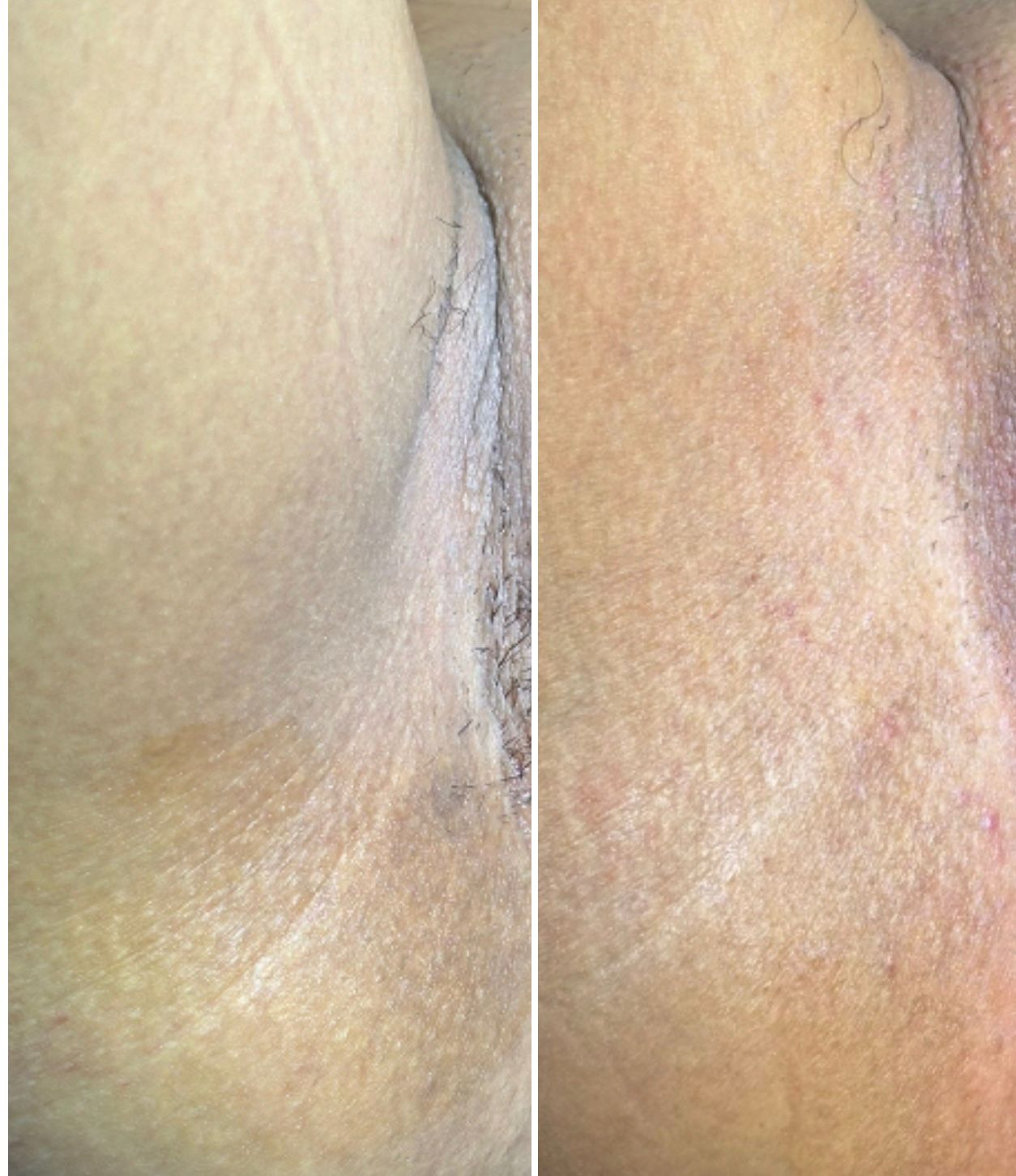 Luminous Skin 5%