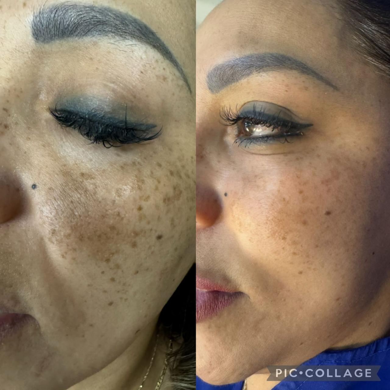 Luminous Skin 5%